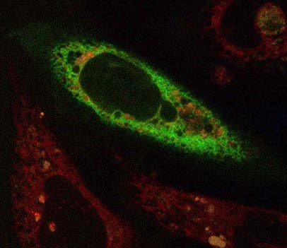 Fluoresecent imaging of mammalian endoplasmic reticulum