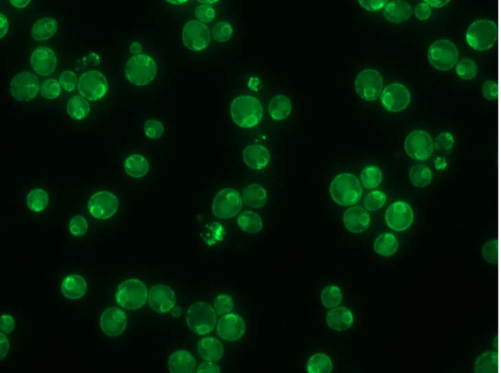 Fluorescent imaging of yeast endoplasmic reticulum