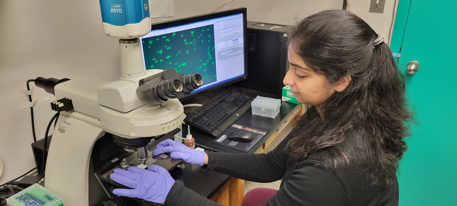 Ph.D. student Aishwarya Ghosh monitors phase separation by live cell imaging of fluorescent protein